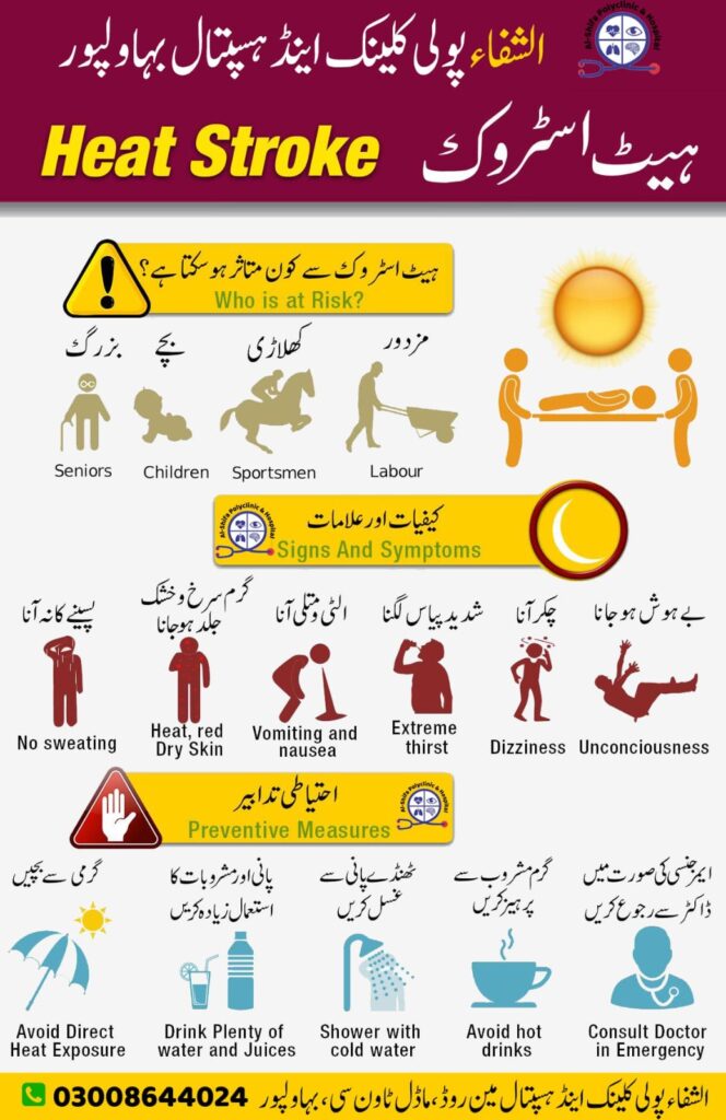 Heat stroke is a severe condition where the body overheats to 104°F (40°C) or more, causing symptoms like confusion and loss of consciousness. Prompt medical attention is vital to prevent life-threatening complications.