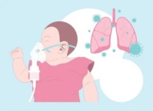 Bronchiolitis