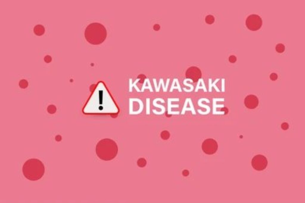 Kawaski Disease