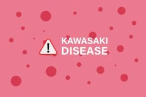 Kawaski Disease