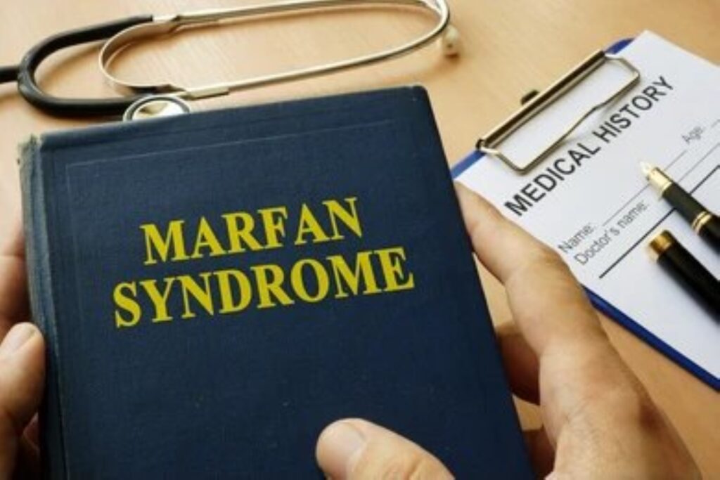 Marfan Syndrome